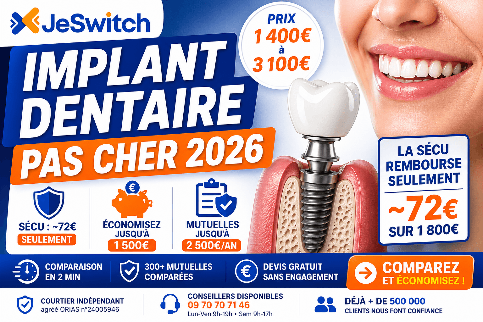 Image de l'article: Implant Dentaire Pas Cher 2026 : Prix, Remboursements et Mutuelles - Actualités mutuelle santé JeSwitch