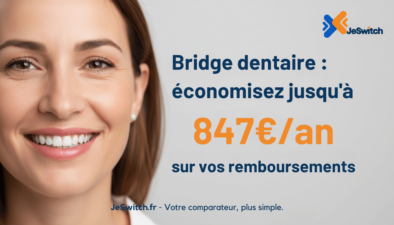 Image de l'article: Bridge Dentaire 2025 : Prix, Remboursement & Guide Complet - Actualités mutuelle santé JeSwitch